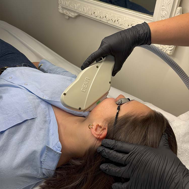 Taches pigmentaires (laser Alexandrite - IPL - laser Q-Switch)